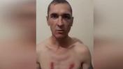 Заключенный рассказывает об избиении в ВКО